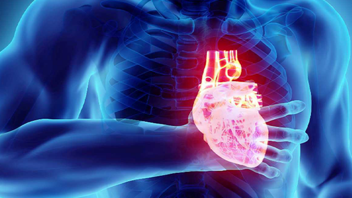 Muerte súbita Cardíaca