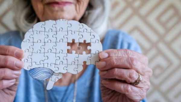 Parkinson
