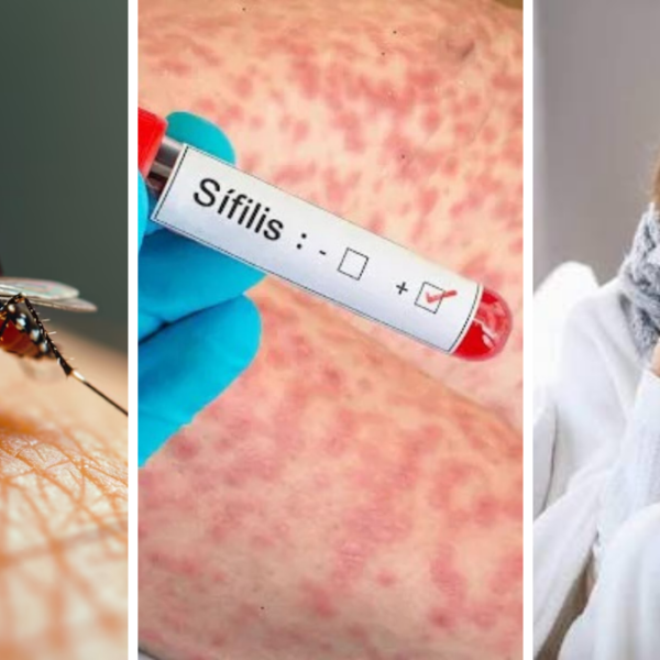 Dengue gripe y sífilis