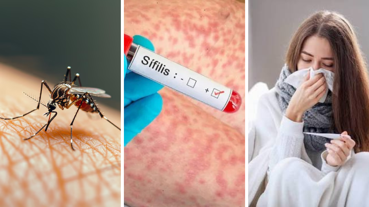 Dengue gripe y sífilis